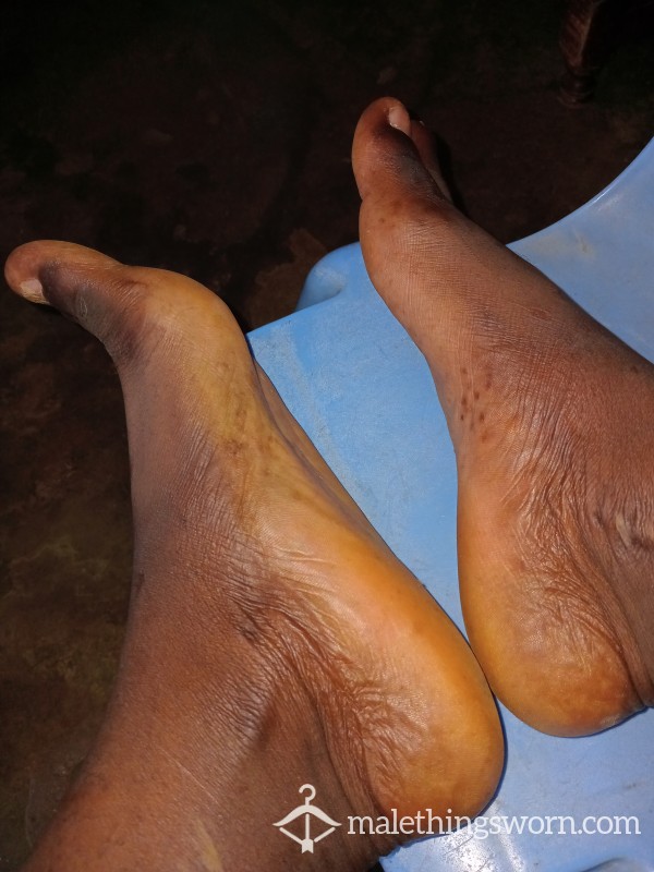 Feet