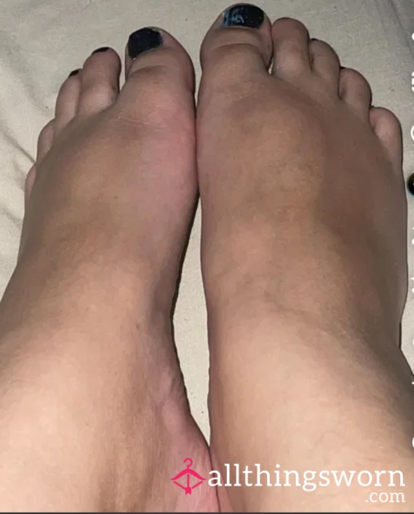 Feet