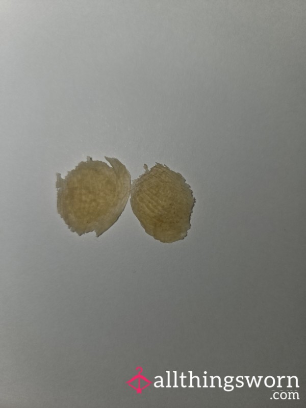 Feet Skin