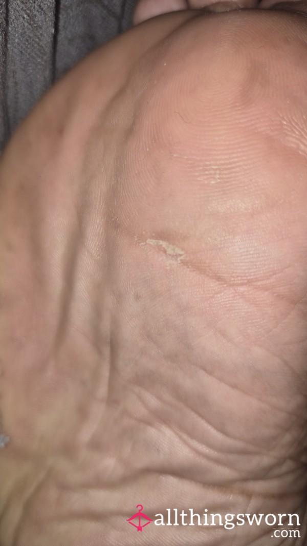 Feet Dust, From A P**ling Foot Mask.