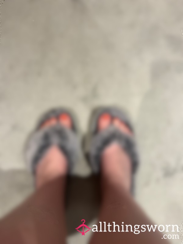 Feet In Crusty, Well-worn Fluffy Slippers