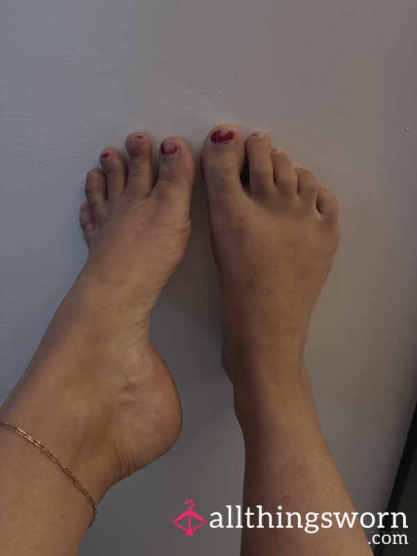 Feet In Need Of Pedicure 🥹