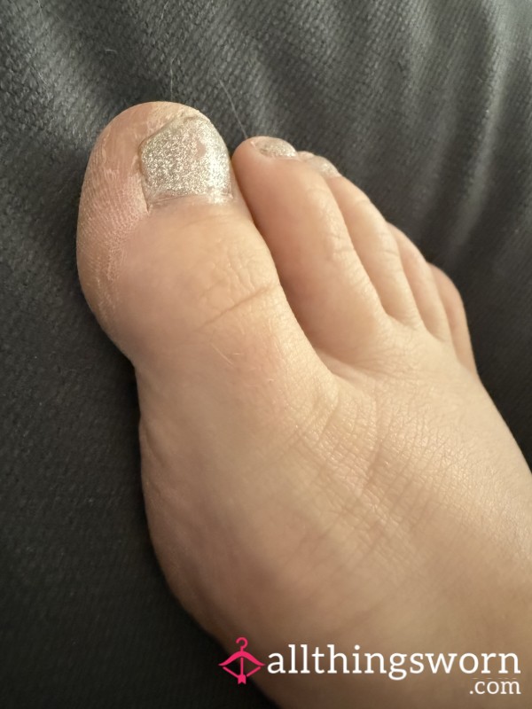 Feet Pics Bevore Pedicure