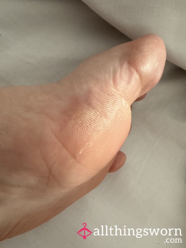 Feet Pics Including My Hard, Dry Skin