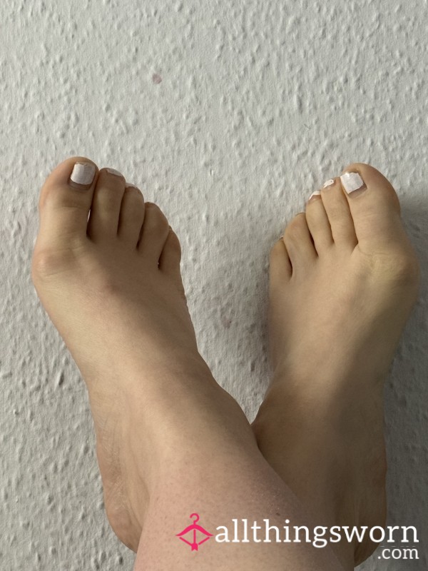 Feet Pics That Are In Need Of TLC
