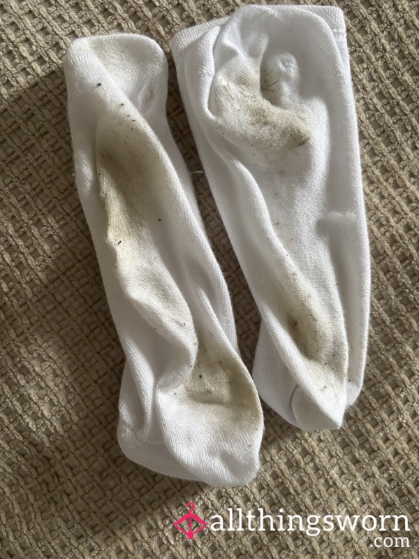 Filthy After 12 Hour Shifts The Sweat Was In Between My Toes And On My Foot Arch