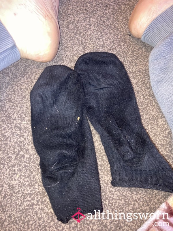 Check Out, My Not So Pretty Feet 🦶