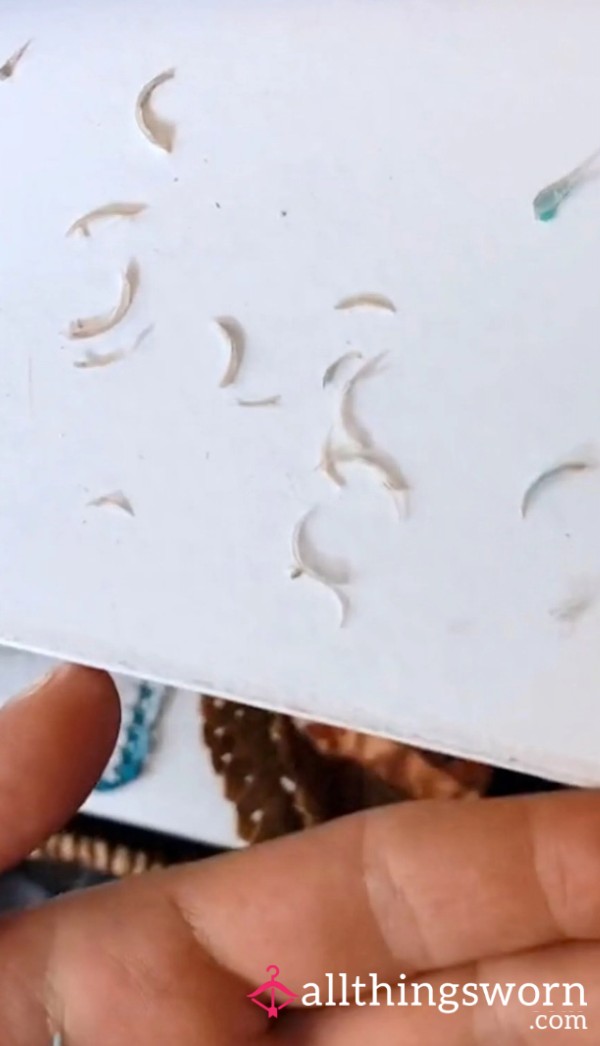 Finger Nail/Toenail Clippings