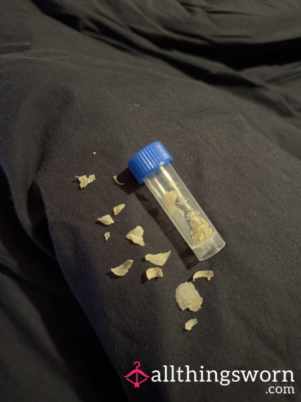 Foot Flakes Vial