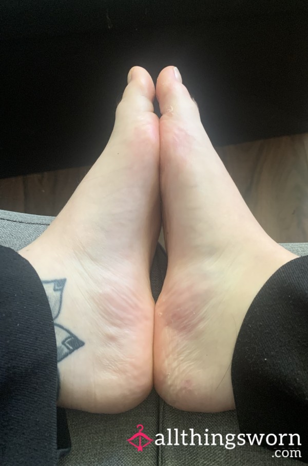 Foot Ignore Call