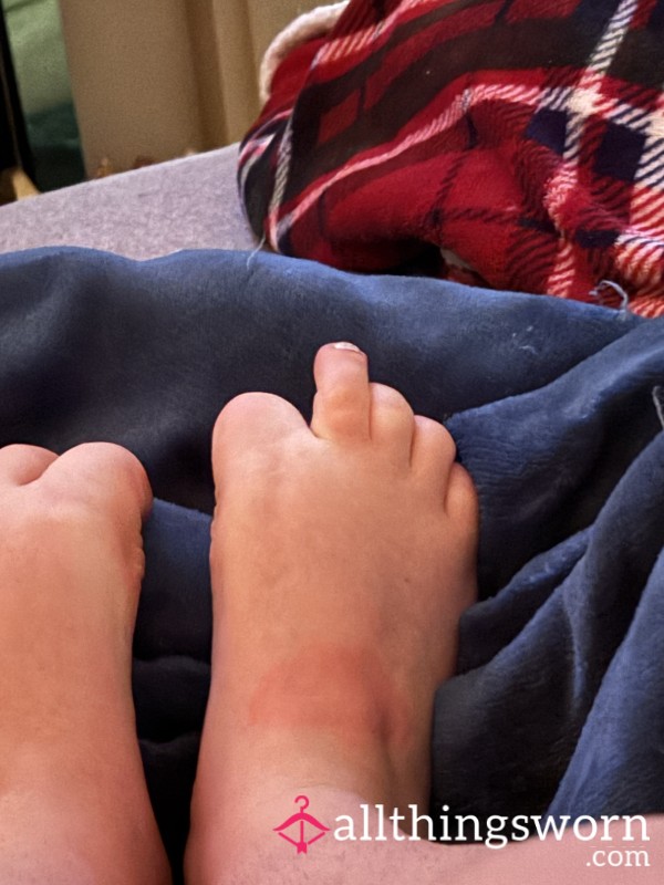 FOOT IGNORE CALLS