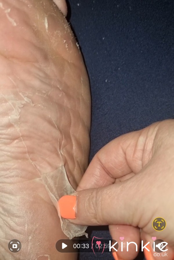 Foot P**l