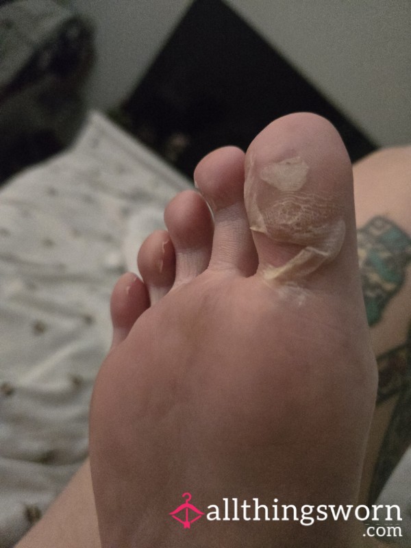 Foot P**l