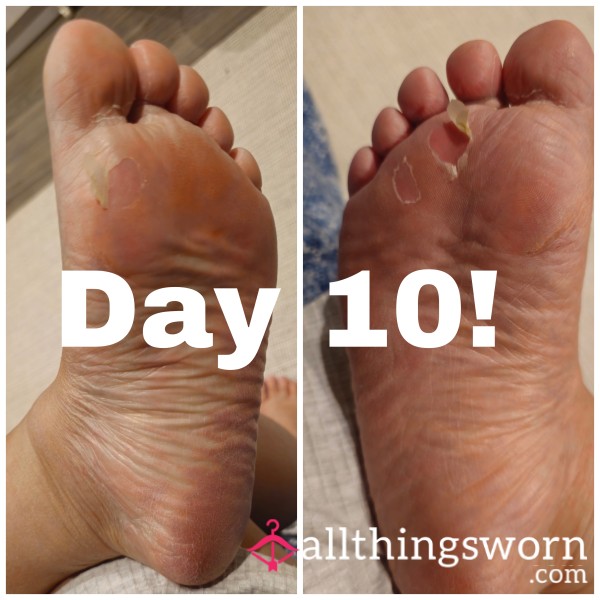 Foot P**l Mask Day 10 And Trimmings!