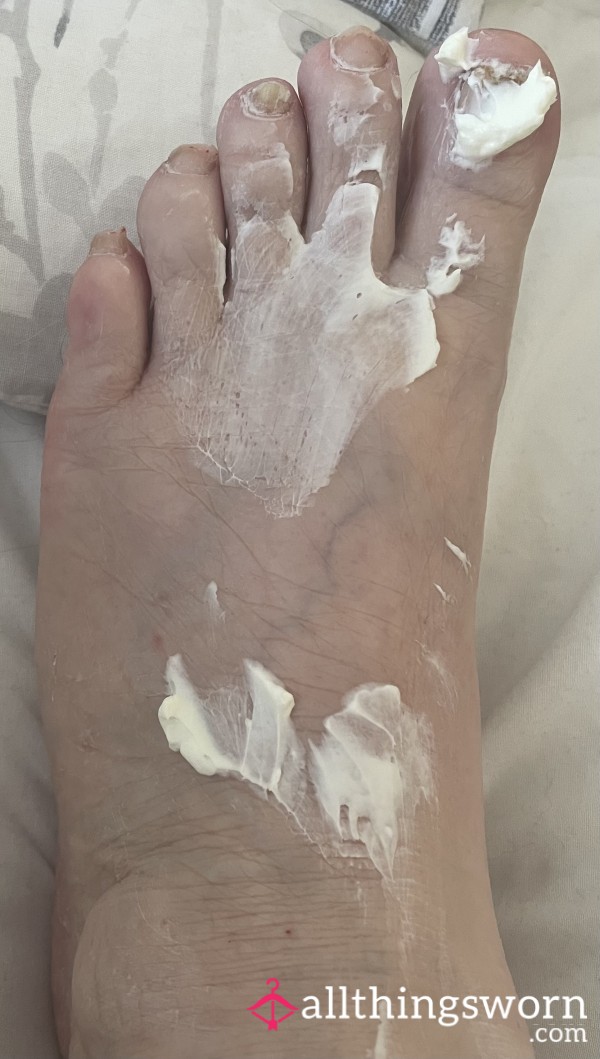 Foot Rub