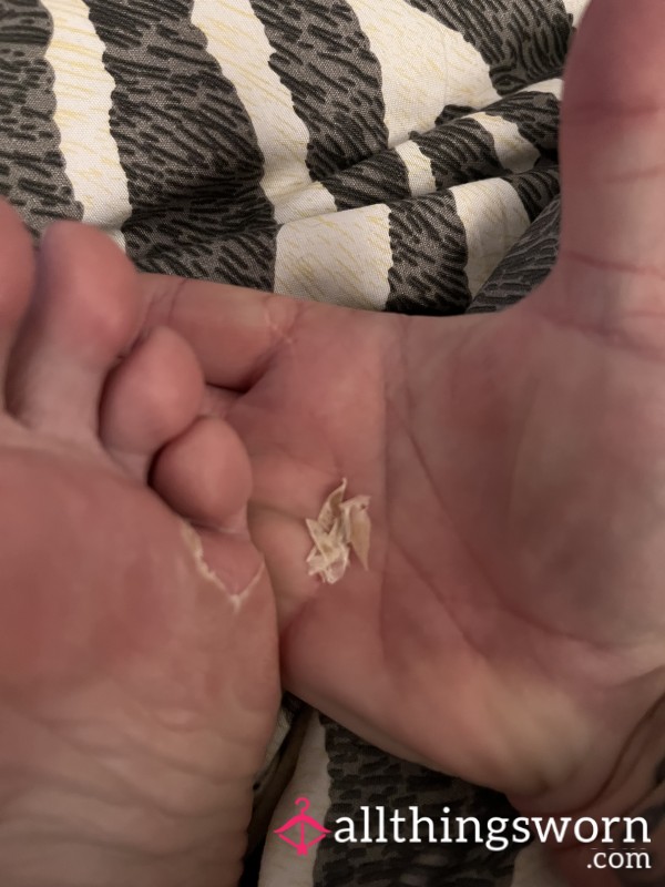 Foot Shaving