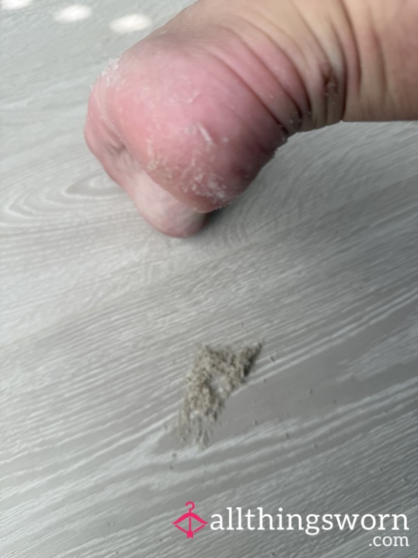 Foot Skin