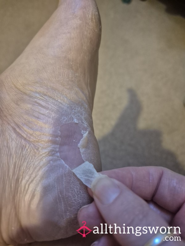 Foot Skin