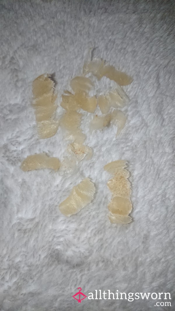 Foot Skin P**l