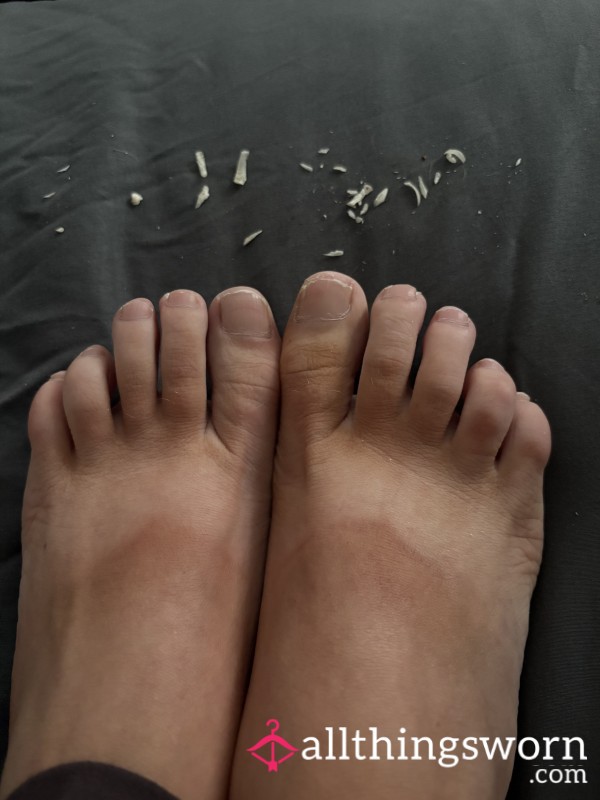 Fresh Feet Waiting Patient To Be Painted