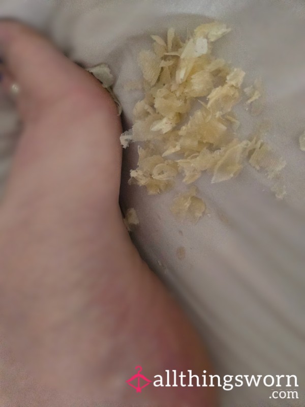 Freshly Harvested Pedi-Flakes – Soft & Exclusive 😍