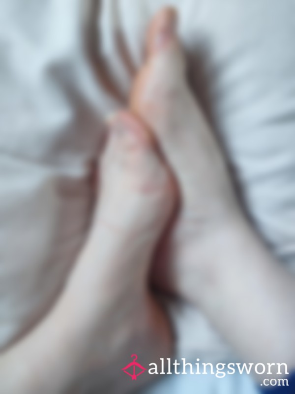 Freshly Picked Toe Blister Skin – Raw & Real Close-Up