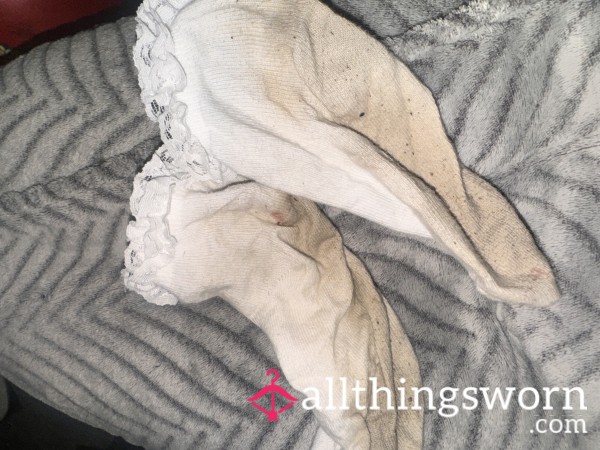 Frilly Socks Worn To A Day Party