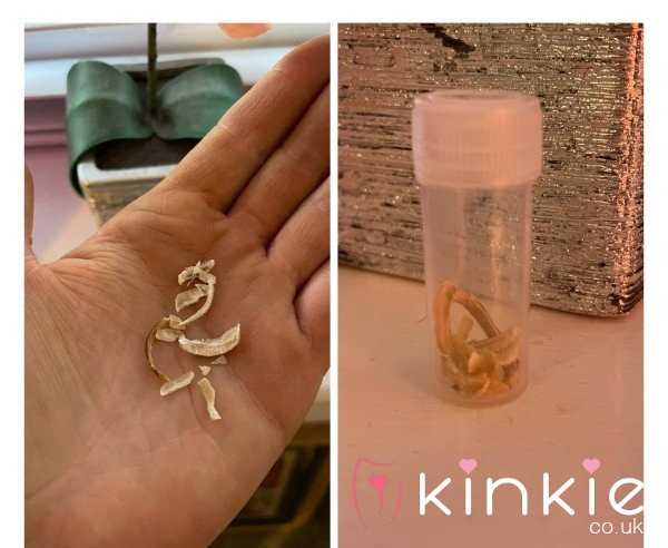 Full Set Of TOENAIL Clippings! 🦶✂️