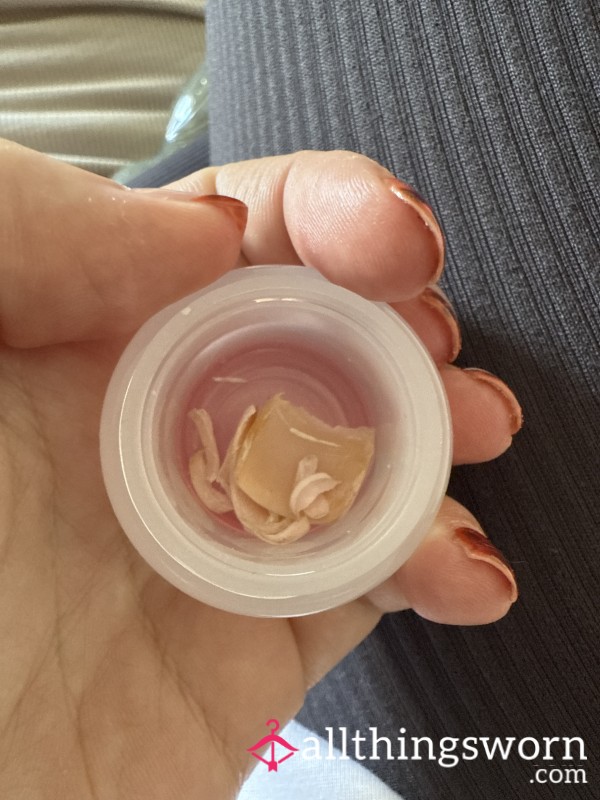 Get Toe Nail Clippings