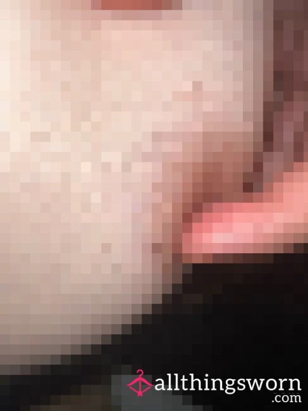 Hairy Nipples