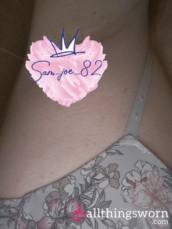 Hairy Underarms (some Pics Are Up Close To See The Individual Hairs)