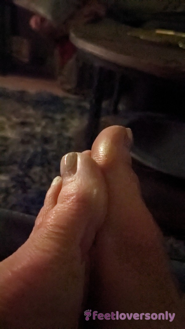 Hard Calluses