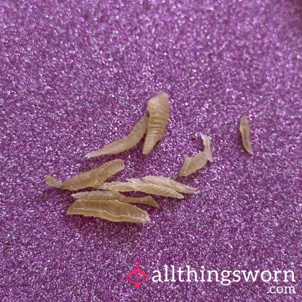 Hard Foot Skin Clippings