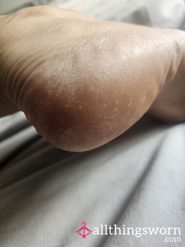 Hardskin  Before Foot Scrub