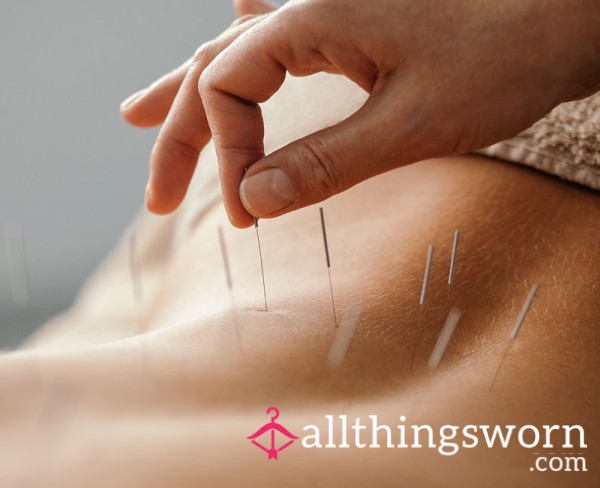 Help Baby Get Some Acupuncture Sessions As I've Been Told It May Help. I Need At Least 10 But They Are £50 Minimum Per Session 😭😭 Any Donations Are Appreciated