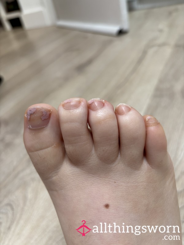 Help Me Get My Toes Done 😫