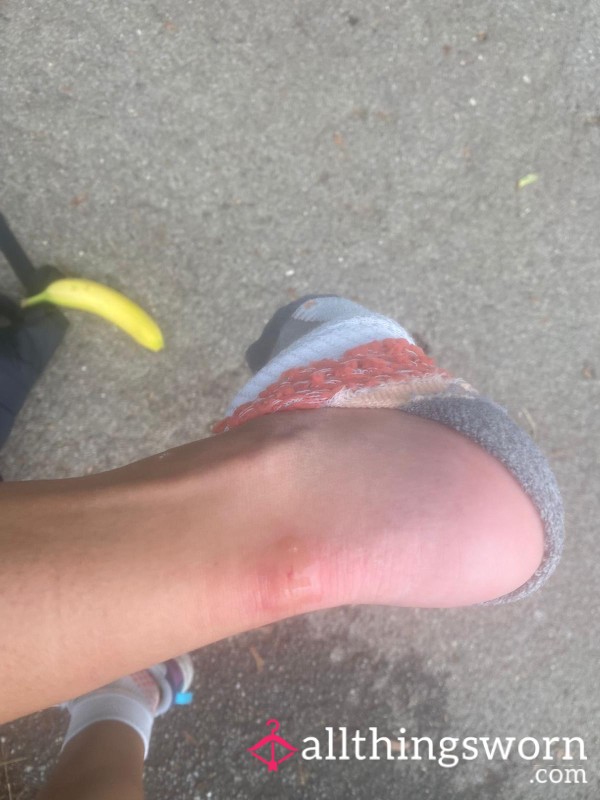 Hiking Feet