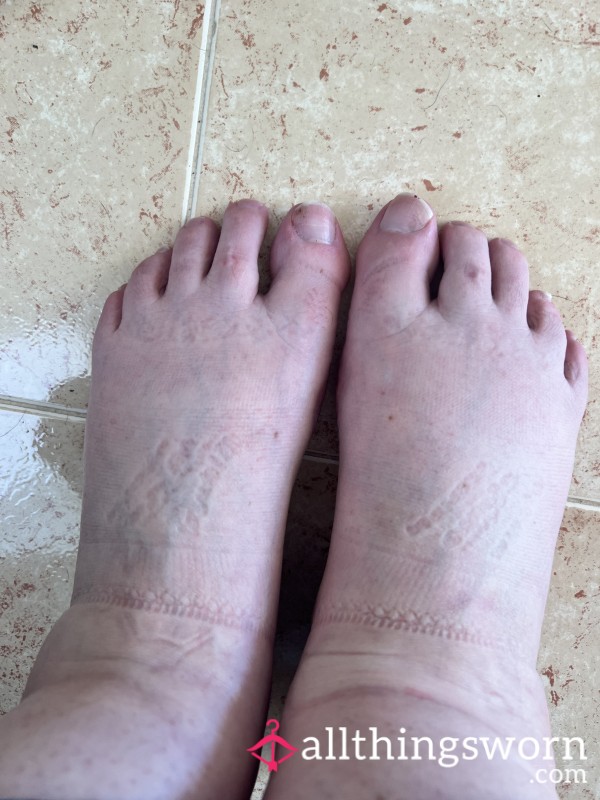 Hot Sweaty Sore Feet