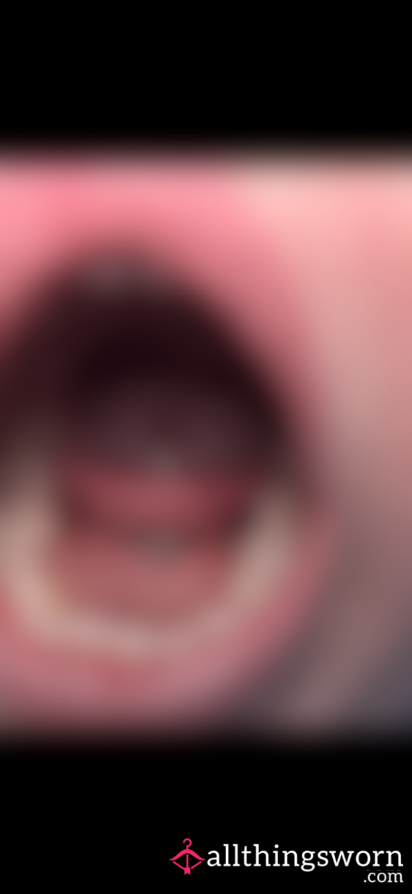 Inside My Mouth 👄🦷😮