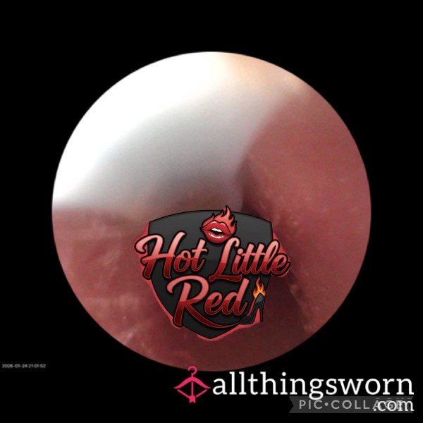 Inside My Sticky Waxy Ears