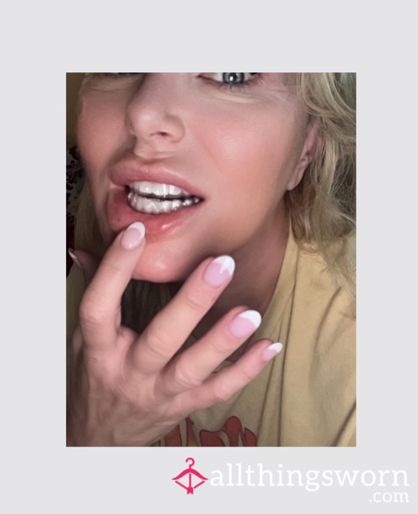 Invisalign Retainer