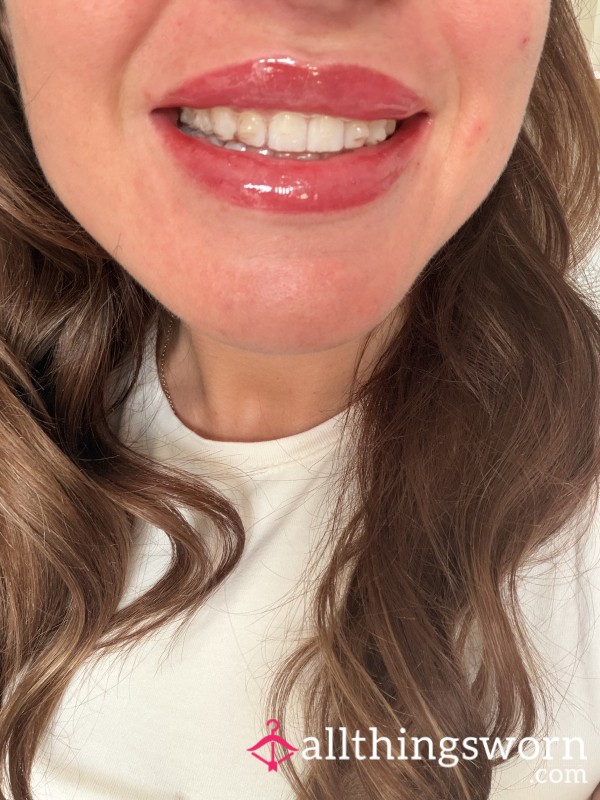 Invisalign / Braces Trays - 154 Hours Covered In My Saliva