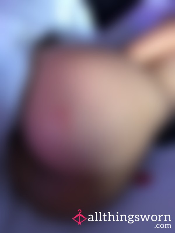 Juicy 🍑 Pic With Bite Mark