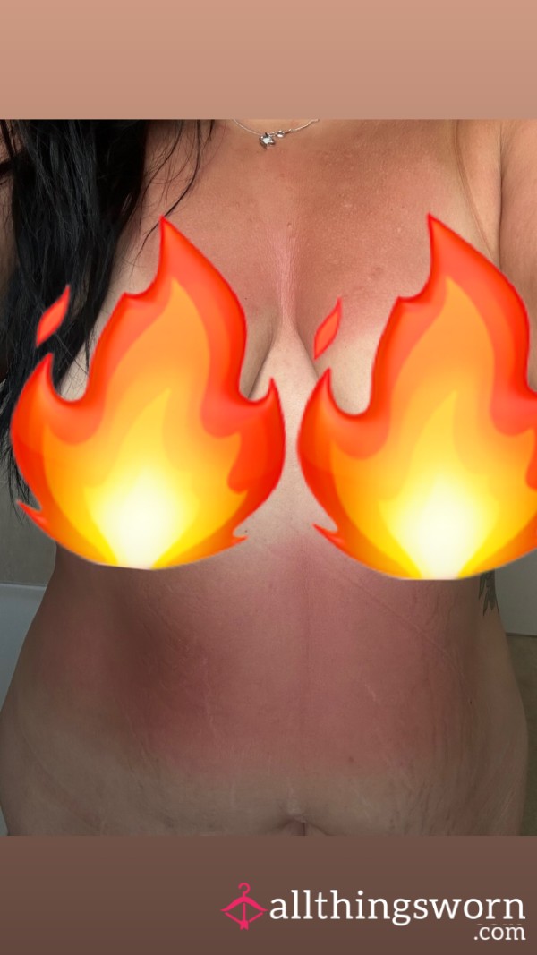 Just A Tad Burnt, Have A Look At My White Bits.