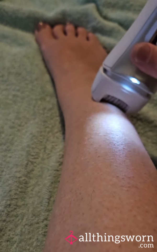 Leg Epilation