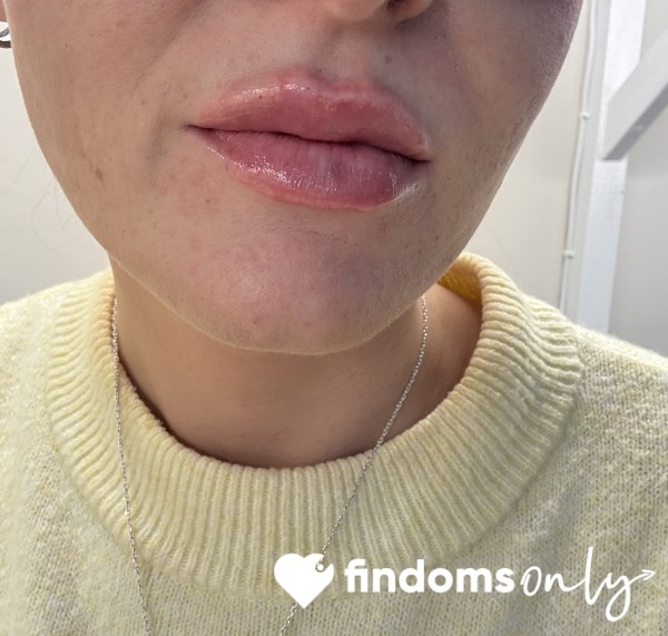 Lip Filler 💋