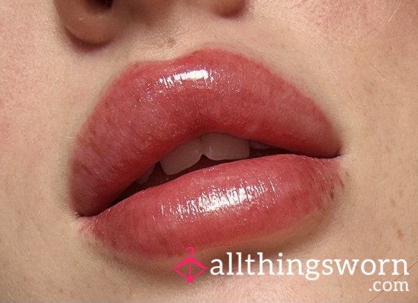 Lip Filler Maintenance