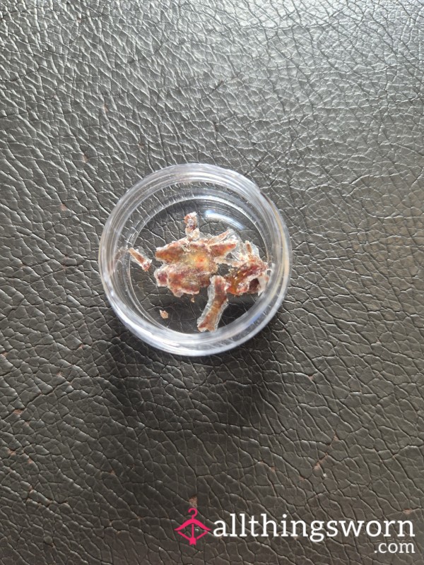 Little Pot Of Scabs, With Picture And Vid