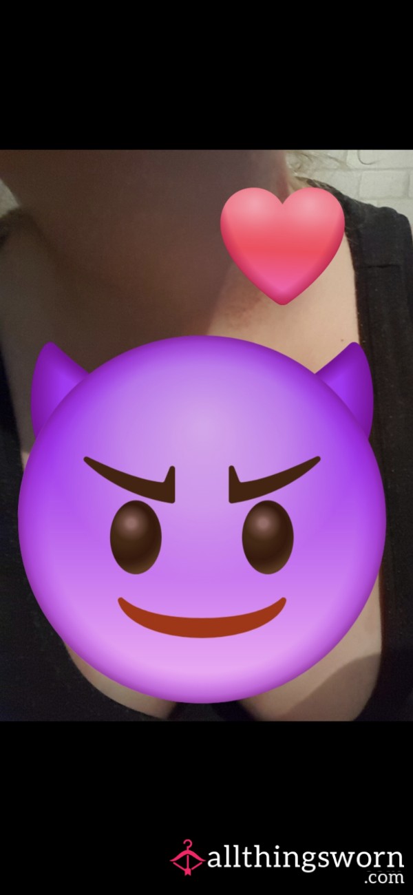 Love Bites & Scratches 🤤😅