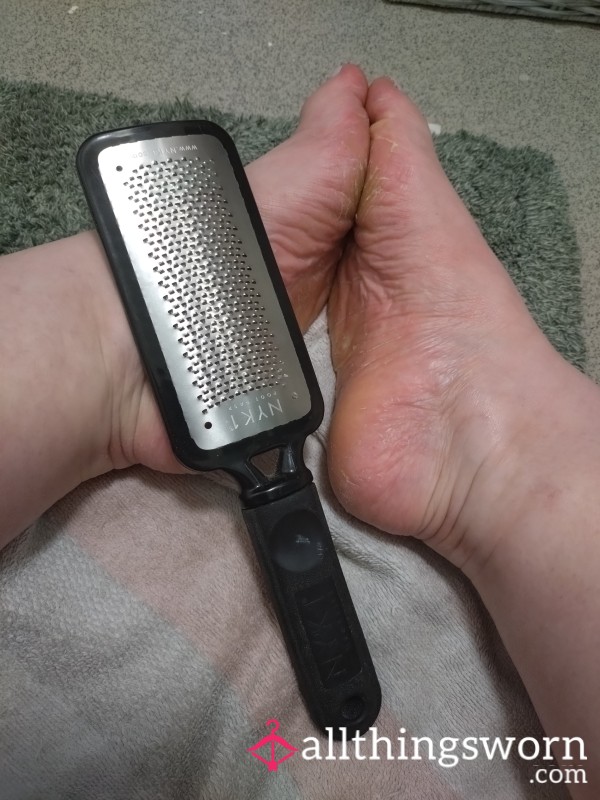 Love Feet, Then Come An Watch Me Get Rid Of My Dried Skin Soles,